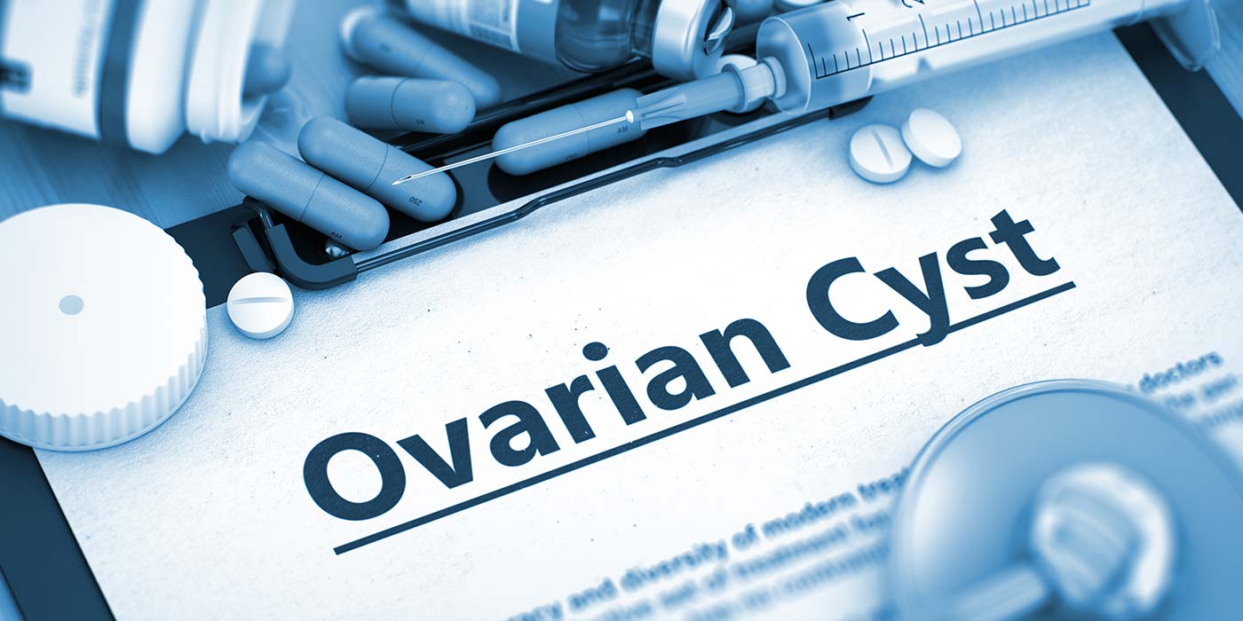 Ovarian Cyst Management